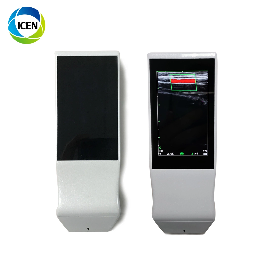 in-A051 Handheld Diagnostic Color Doppler USG Echo Scanner Wireless Probe Scanner with Screen Low Price