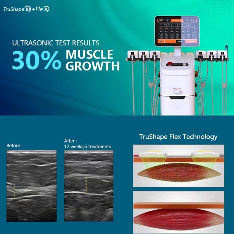 Жира Trushape растворения здание вертикальной мышцы RF горячей потеря веса машины