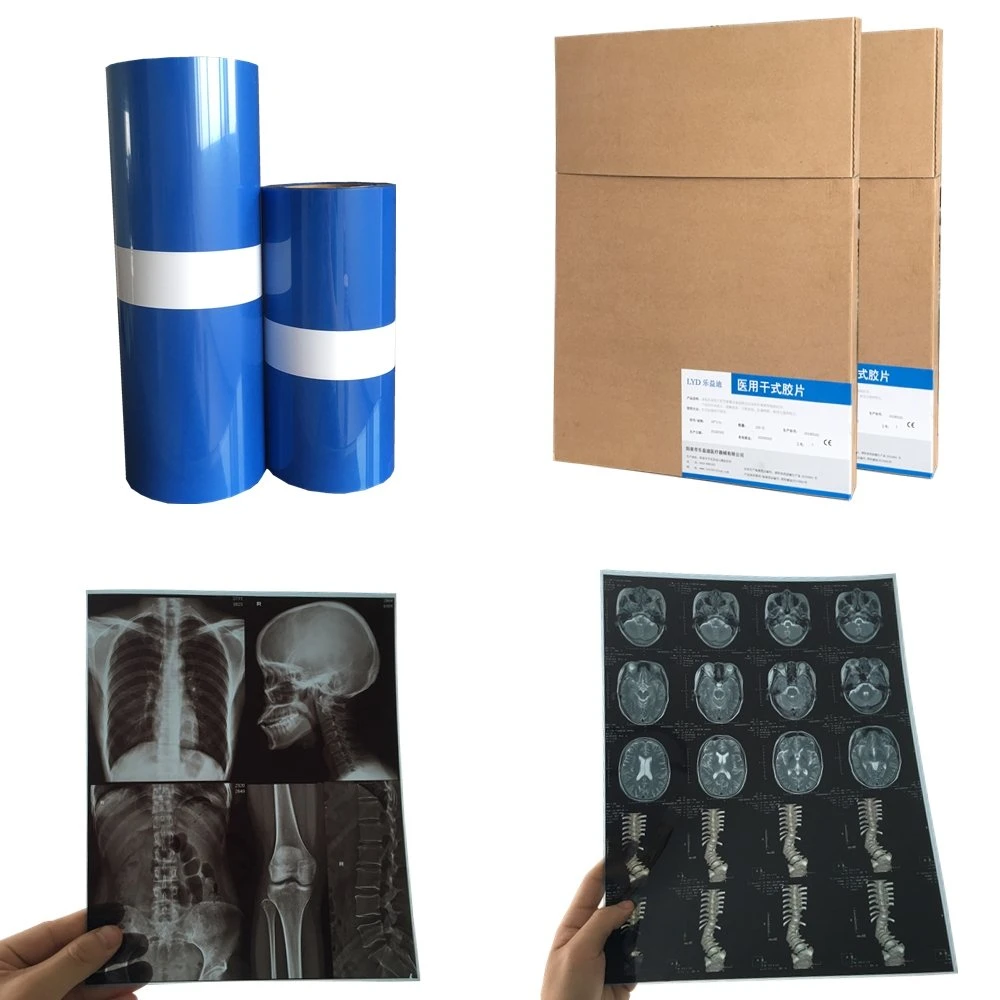 Pet Medical Inkjet X-ray Blue Film Manufacture