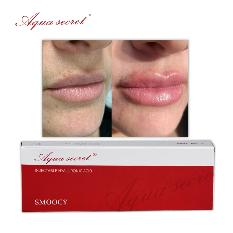 Aqua Secret 1ml 2ml Face Dermal Filler Revolax Injection for Lip Facial Online