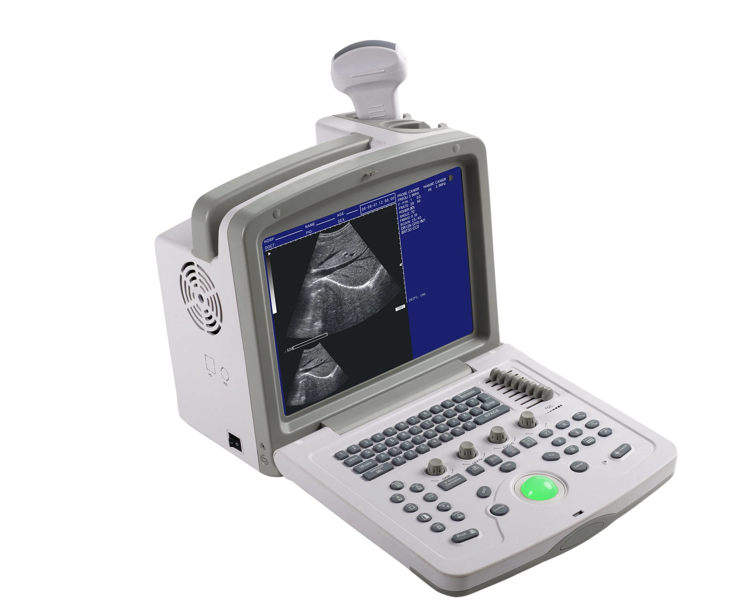 Medical Ultrasound Machine Laptop Portable Ultrasound Scanner