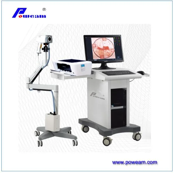 Poweam Medical LED/Halogen Colposcopy/Colposcopic Examination