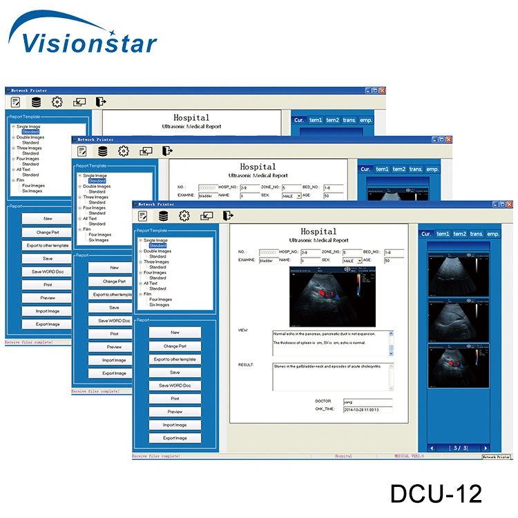 Dcu-12 Color Doppler Ultrasound Scanner (Veterinary)