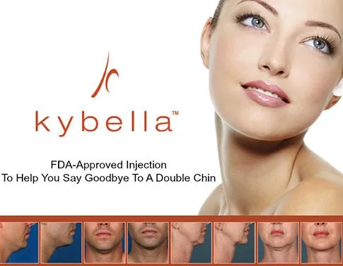 Kybella FDA Approved Injectable Treatment Dissolved Fat for Reducing Submental Fat Pad Excess Aka Double-Chin