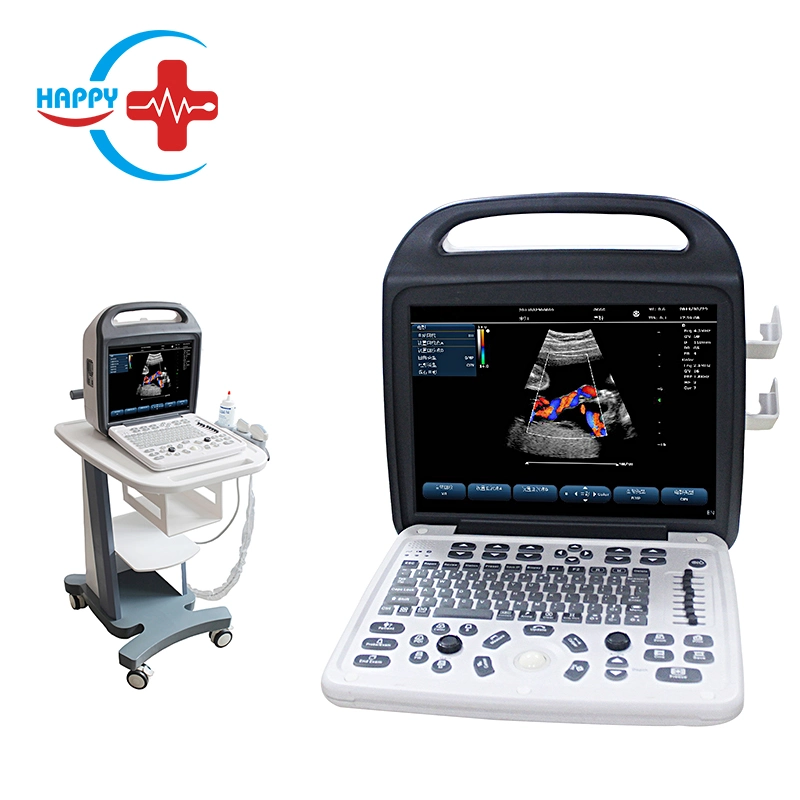 HC-A012 Super Hot 3D Color Doppler Portable B Ultrasound Scanner