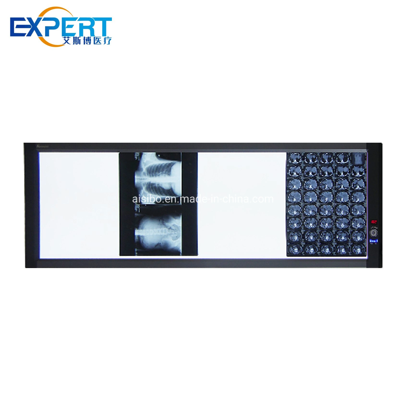 Hospital Equipment LED Ultra-Thin LCD Film Viewer X-ray