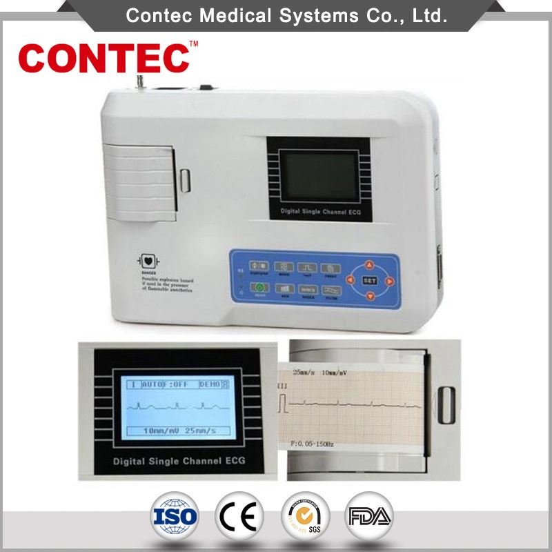 Equipamento do conjunto de diagnóstico de Entr hospitalar da máquina de ECG digital de um canal