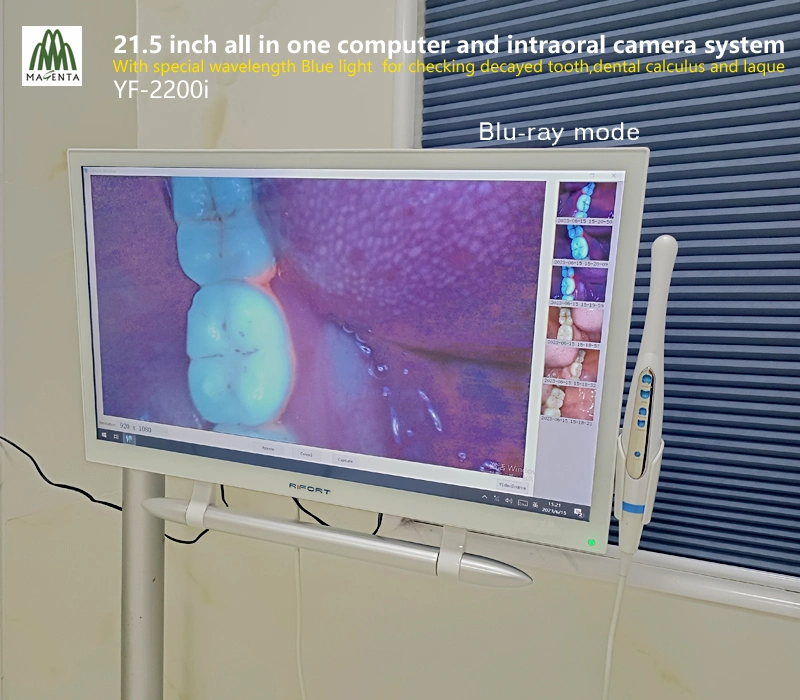 Configuração de alta 21,5" de tela sensível ao toque Windows 10 e Oral Dentária Unidade de câmara com luz azul para dentes cariados/cálculo matemático e placas