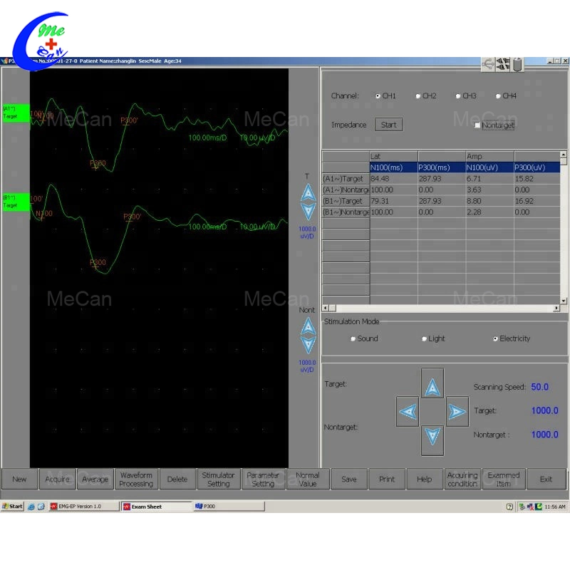 Medical Emg Device Portable Emg/Ep System Electromyography System