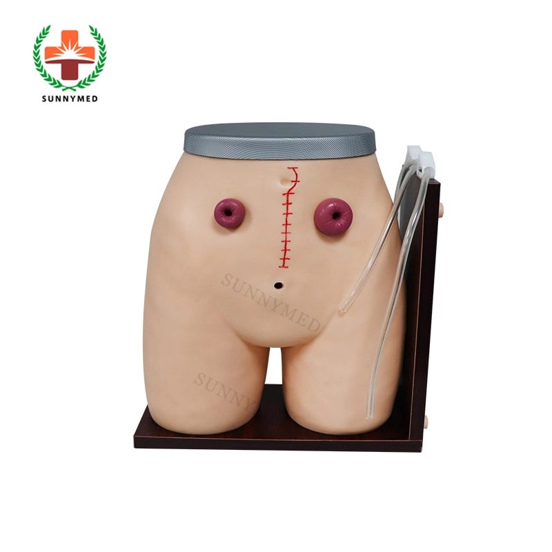 Sy-N059 Human Anatomy Ostomy Nursing Model Manikin for Training
