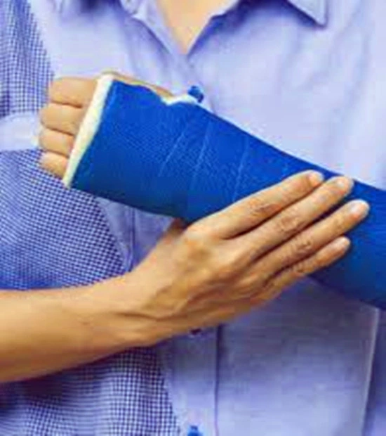 Fiberglass Fabric Multi-Color Medical Orthopedic Plaster of Pairs Bandage