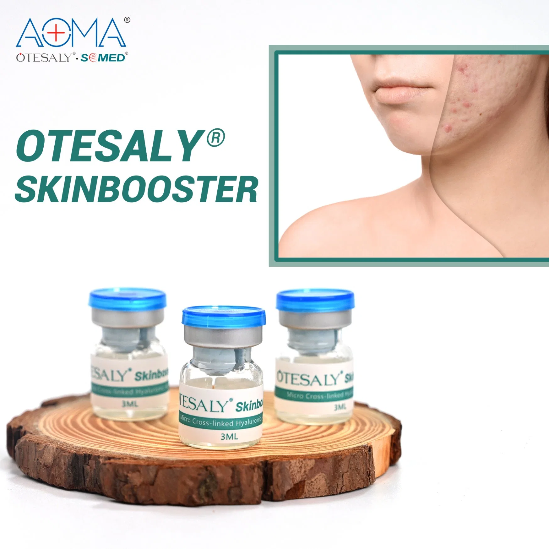 Wholesale/Supplier Otesaly Skinbooster Hyaluronic Acid Solution Serum Hyaluronic Acid Mesotherapy