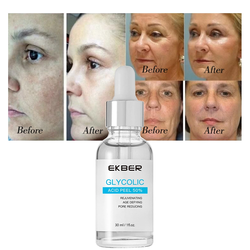 Набор из глицериевой кислоты Chemical Peel Melasma Kit Anti Aging Anti Wrinkle Восстановление сыворотки шрамы Acne Брайтенс