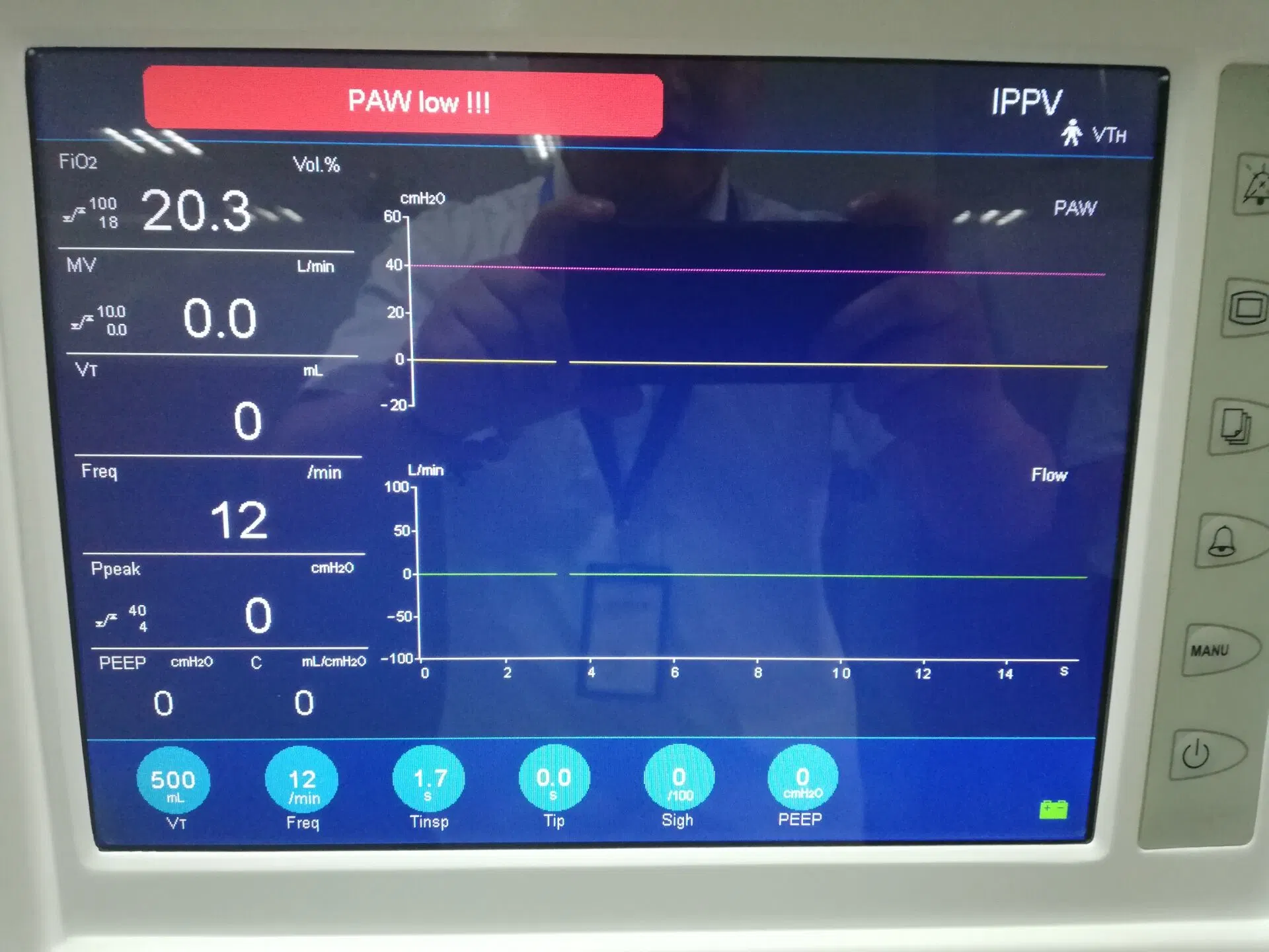 Respiratory Machine High-End ICU Breathing Apparatus for Hospital