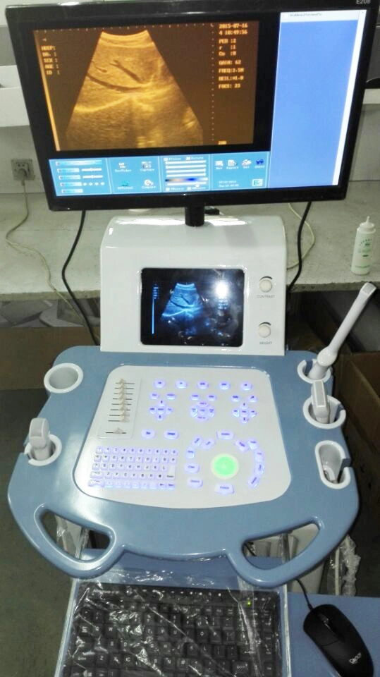 Digital Medical Ultrasound Imaging System (THR-US8800)