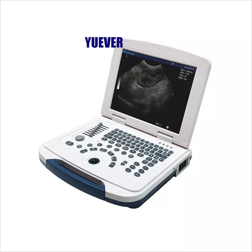 Yuever Medical Prix ce approuvé portable médical portable portable B/W Échographe avec capteur convexe