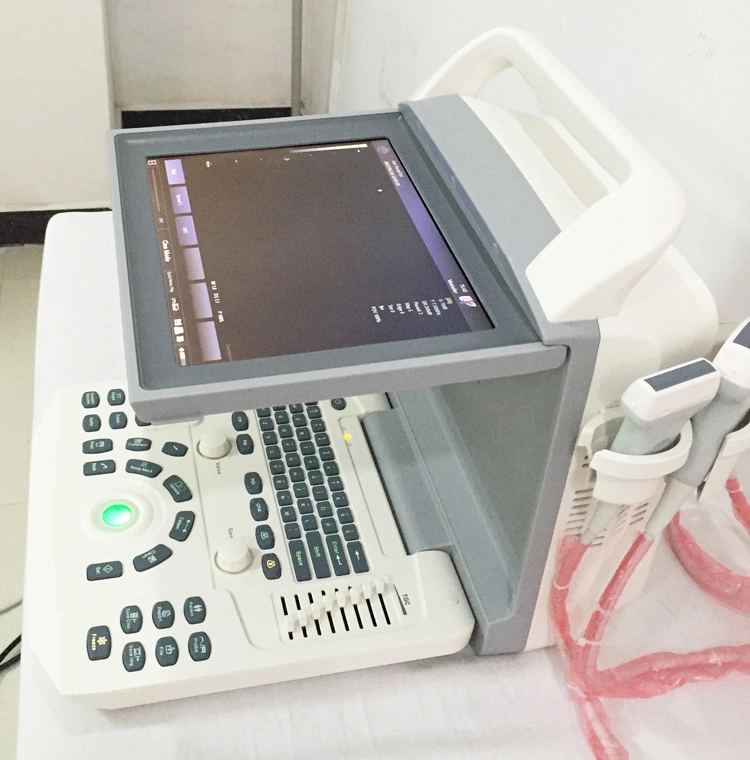 My-A026 All Digital Color Doppler Ultrasonic Diagnostic System 12.1 Inch Portable Doppler Ultrasound Machine