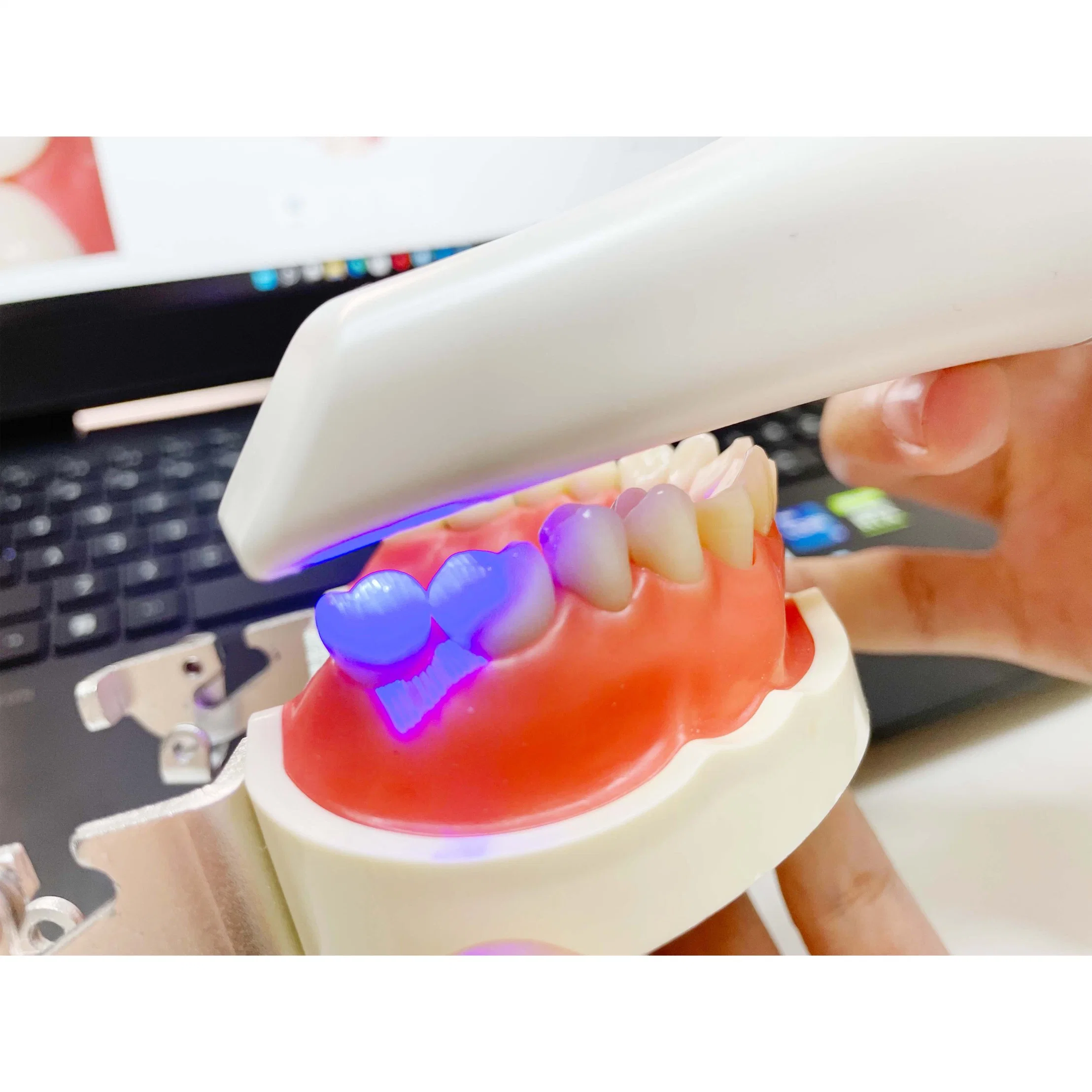 كاميرا CAD Cam الرقمية ماسح الأسنان ثلاثي الأبعاد Dental Lab Mini ماسحة ضوئية محمولة مزودة ببرنامج مجاني