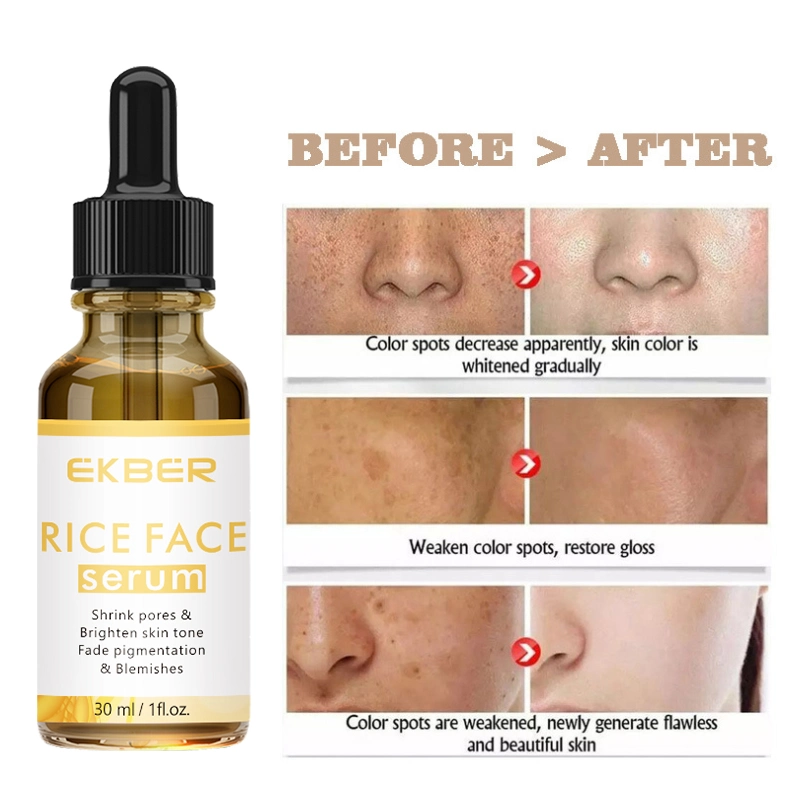 Face Care Whitening Refine Wrinkles Skin Care Moisturizing Custom Logo Rice Serum