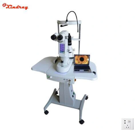 China Mini Retincal Fundus Camera with Built-in Computer