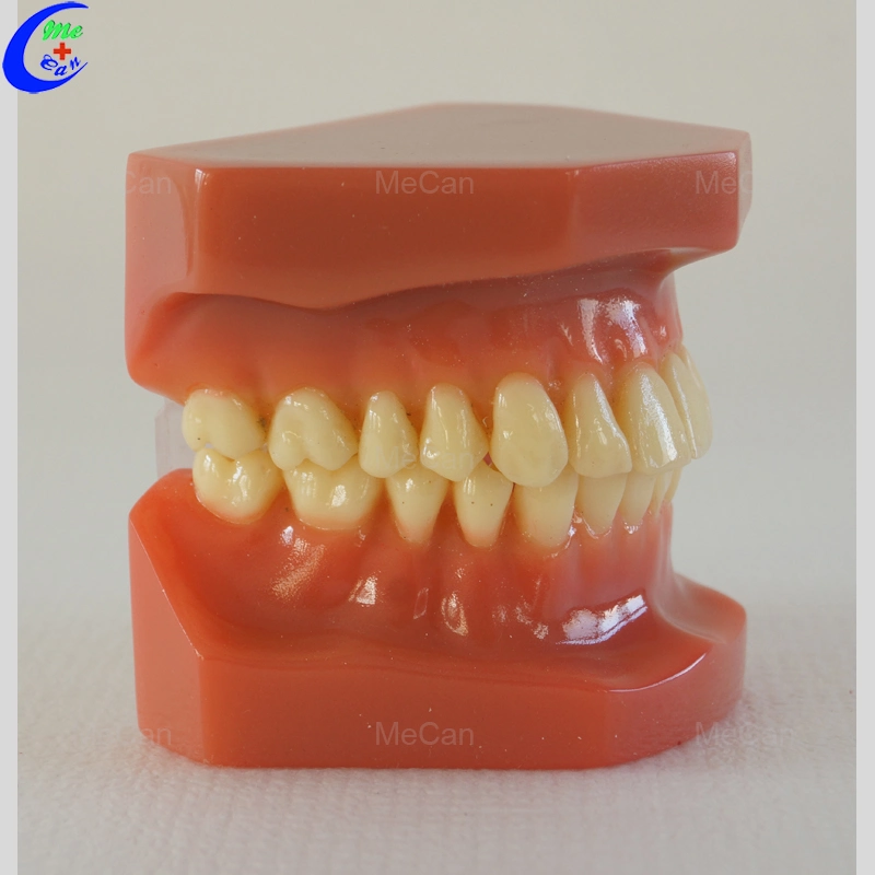 نموذج دراسة الأسنان، أسنان الأسنان، نموذج تقويم الأسنان