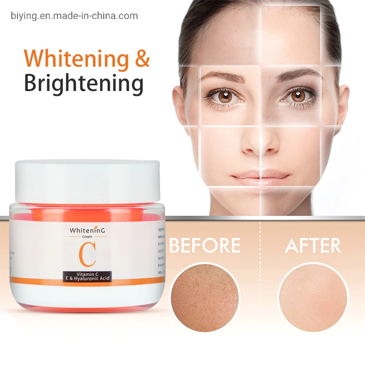 Skin Care Vitamin C &amp; E Whitening Facial Cream Fade Freckles Remove Dark Spots Melanin Remover Brightening Face Cream