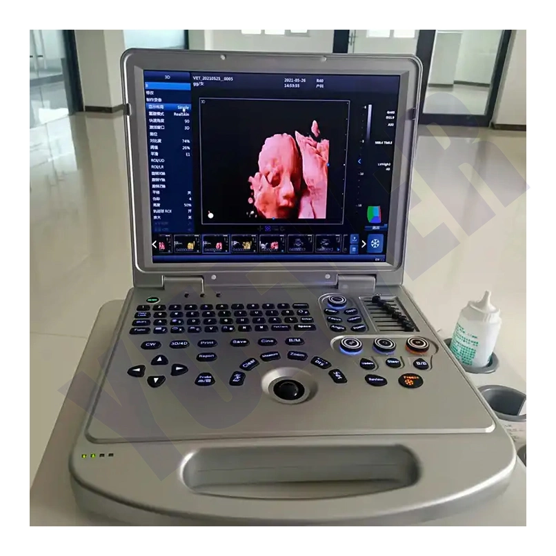 Manufacturer Professional Portable 2D/3D Color Doppler Ultrasound Medical Equipment Hospital Ultrassom Instruments Ultrasonic