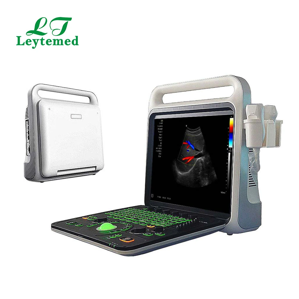 Ltub64 Medical Gynecology Obstetric Full-Digital USB Color Doppler Ultrasound USG