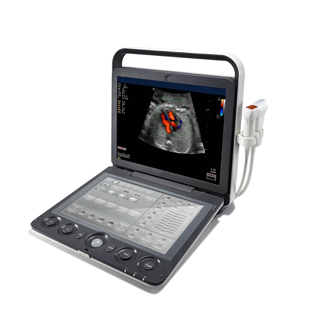 Sonoscape S9 Medical Ultrasound ultrasonic Instruments, Portable Color Doppler 4D Ultrasound Machine