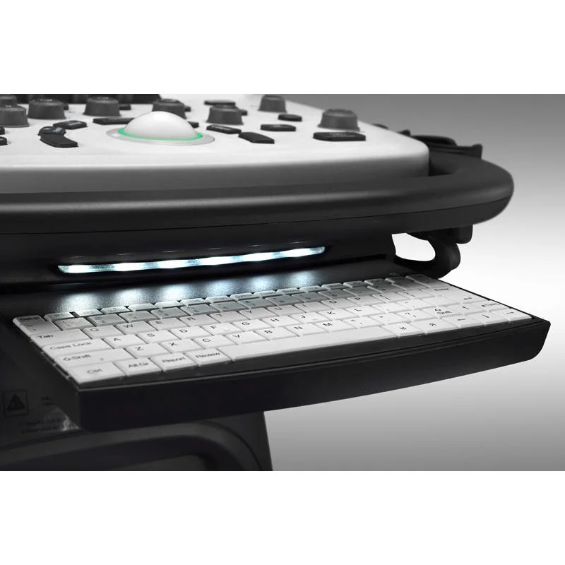 Sonoscape S8exp Powerful Portable 4D Color Doppler Ultrasound Scanner