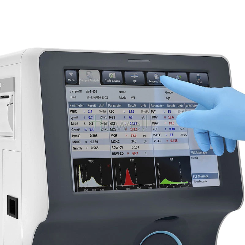 Klinische Analysegeräte Bc-30 Auto Mindray Hämatologie Analysator Preis Hämatologie Analysator