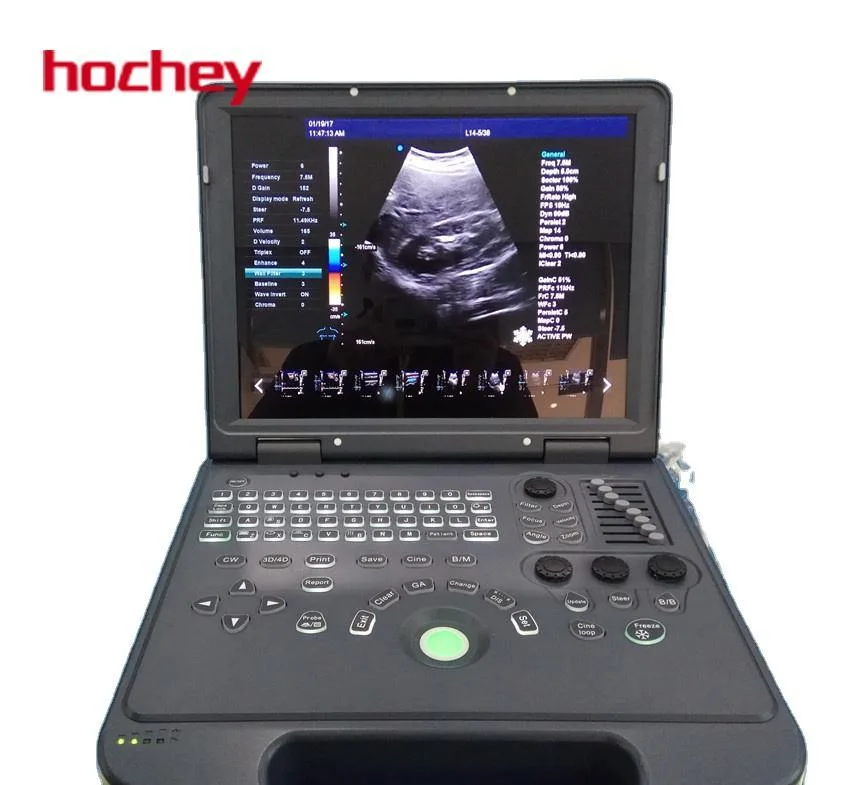 Hochey Medical Medical Hospital High Quality Standard Digital Portable Ultrasound Scanner Therapeutic Sonograph Ultrasound Machine Portable