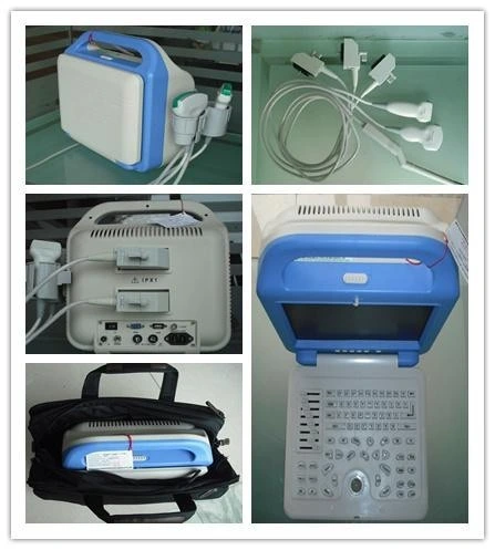 New Portable LCD Display Ultrasound Scanner with a Convex Probe