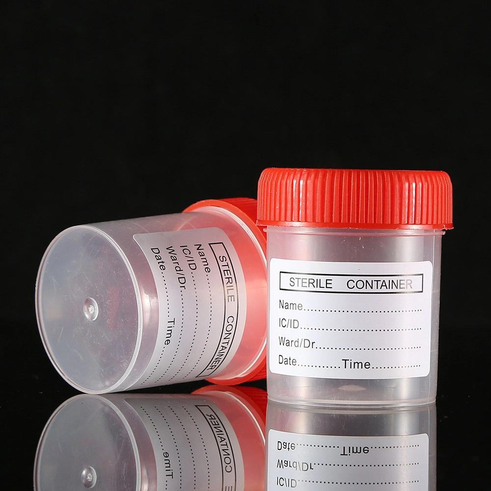 Disposable Laboratory Medical Test Sample Urine Container /Specimen Wholesale/Supplier