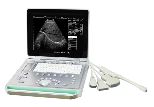 Laptop Fully Digital Ultrasound Scanner
