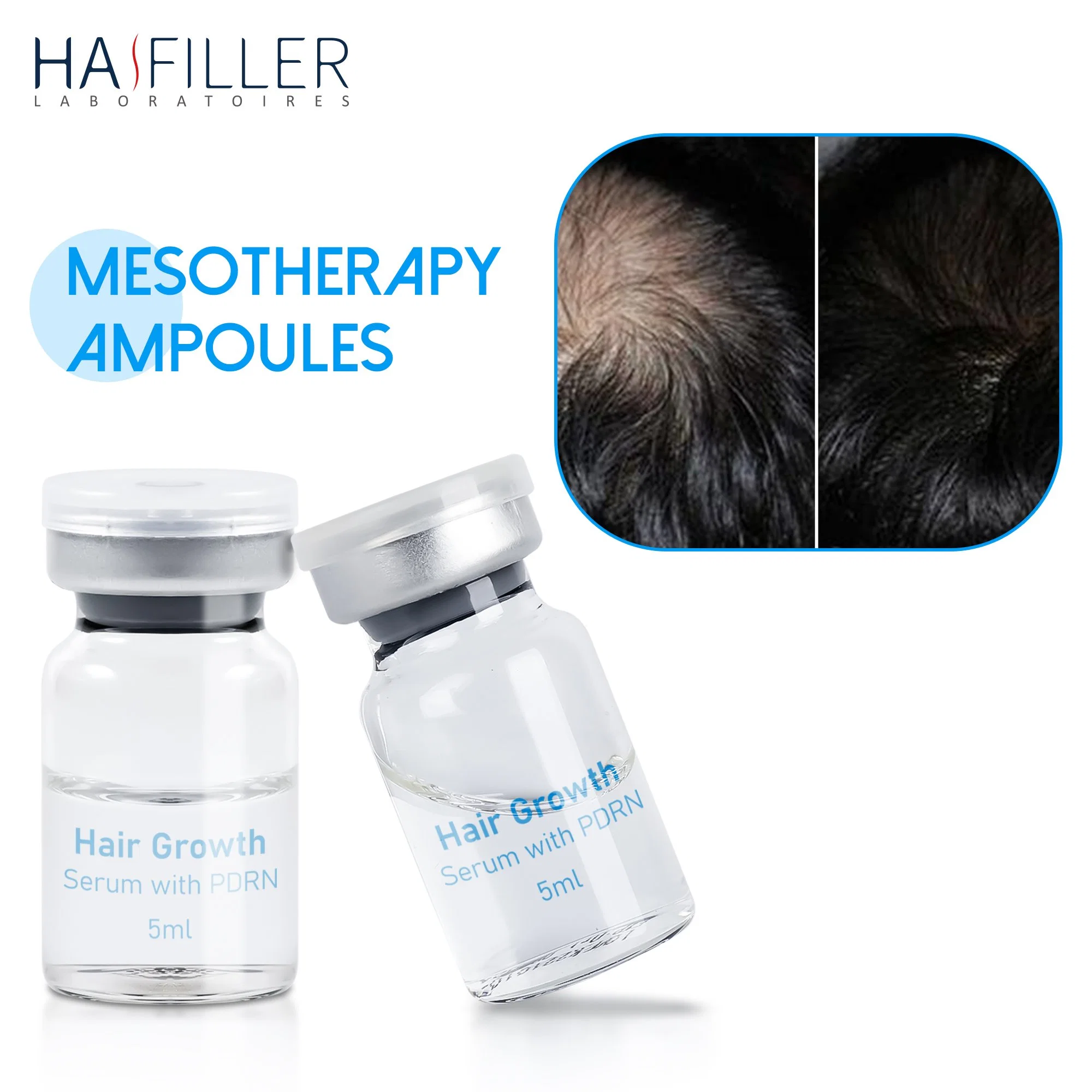 Heißer Verkauf Microneedling Anti Haarausfall Ampole Pdrn Injektion Haar Wachstum Serum Schönheit Mesotherapie