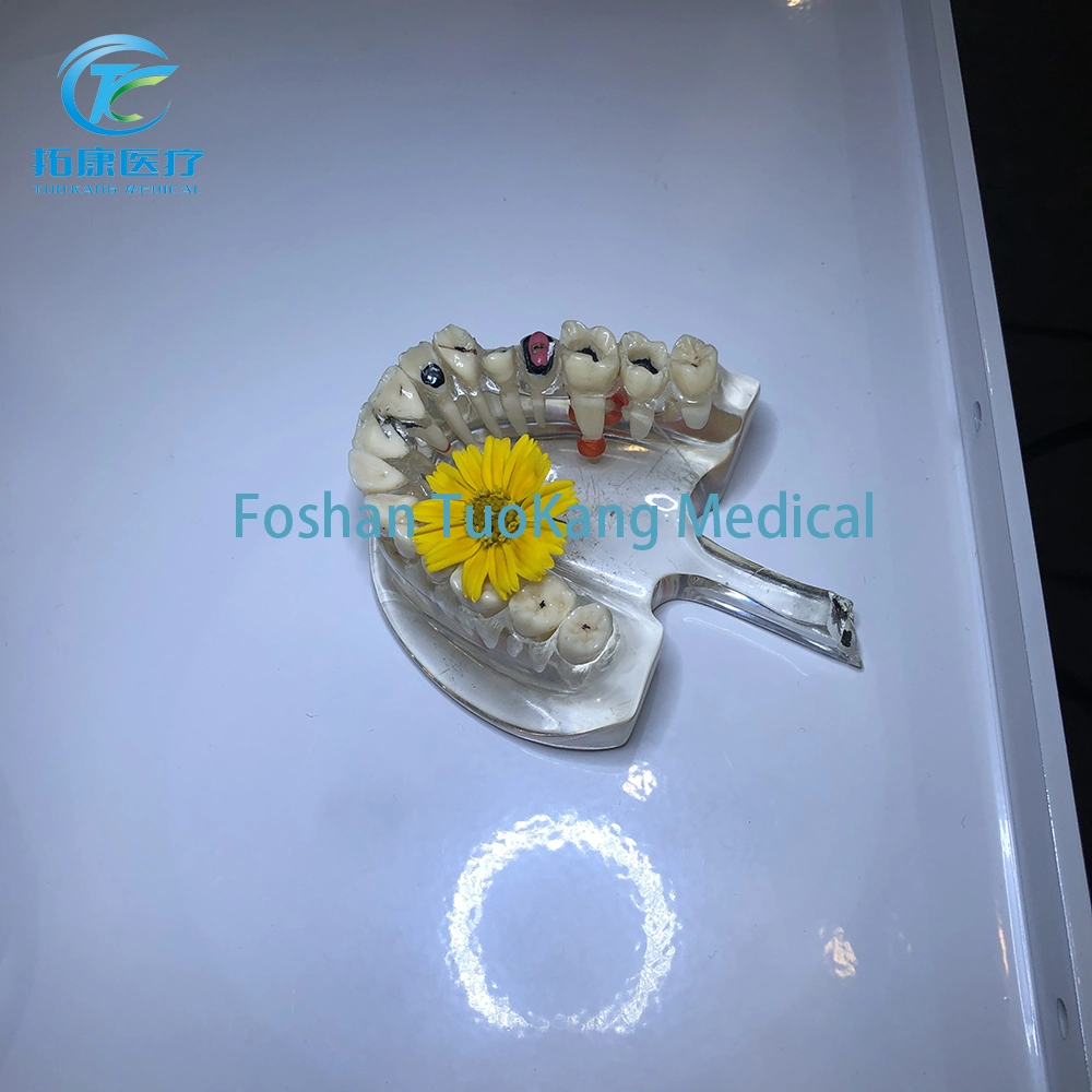 2020 Dental Microscope Video Clip Type Microscope Dental Endodontic Dental Intraoral Microscope for Sale