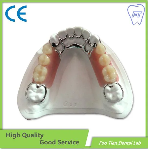 High quality/High cost performance  Removable Denture Cast Partial Framework Dental Customized