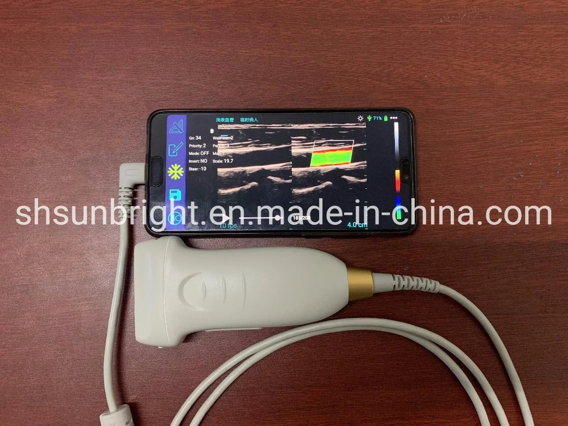 Affordable Color Doppler Software Pw Vascular Test Linear Probe