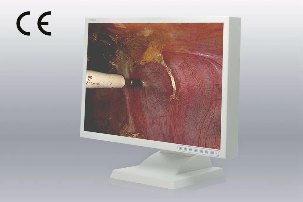 24-Inch 1920X1200 LCD Screen Ce Approved Endoscopy Monitor