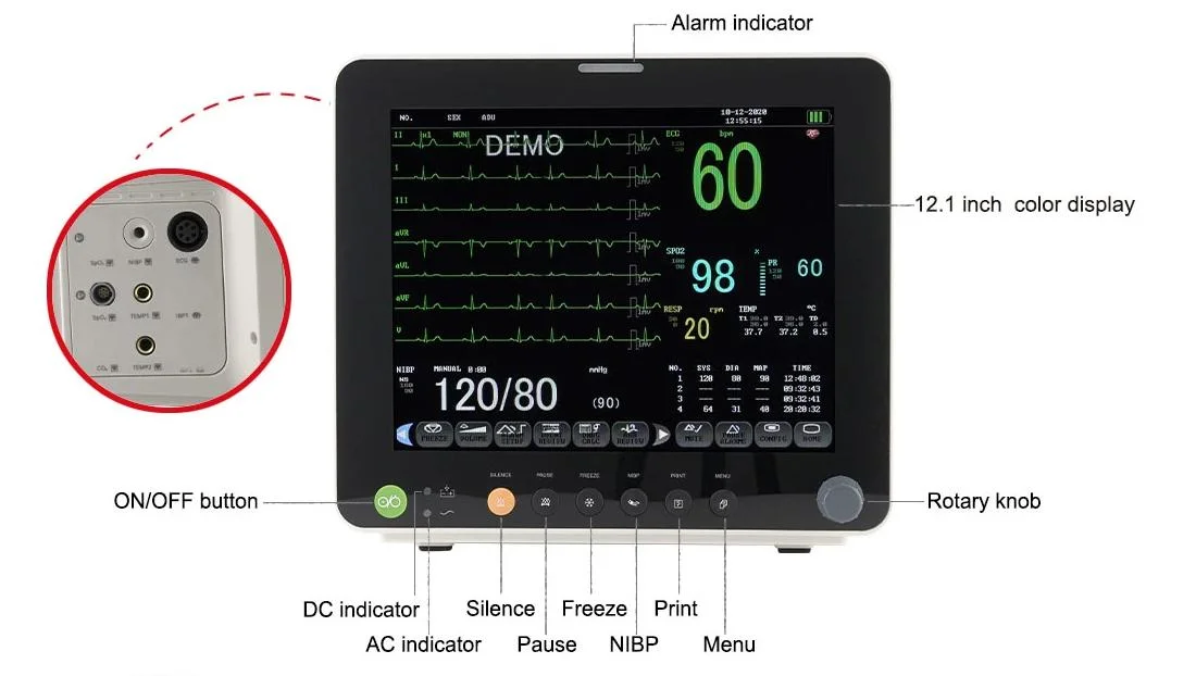 Fabricante Hospital portátil de 15" pulgadas de cabecera de la ICU de Signos Vitales multiparámetros Monitor de Paciente con CE y FDA Approved