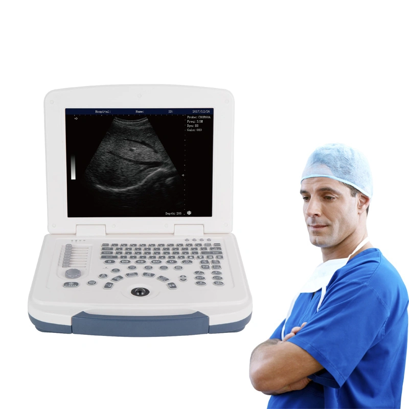Portable Ultrasound Veterinary Ultrasound Scanner for: Dog. Cat. Pig. Cow. Sheep. Horse