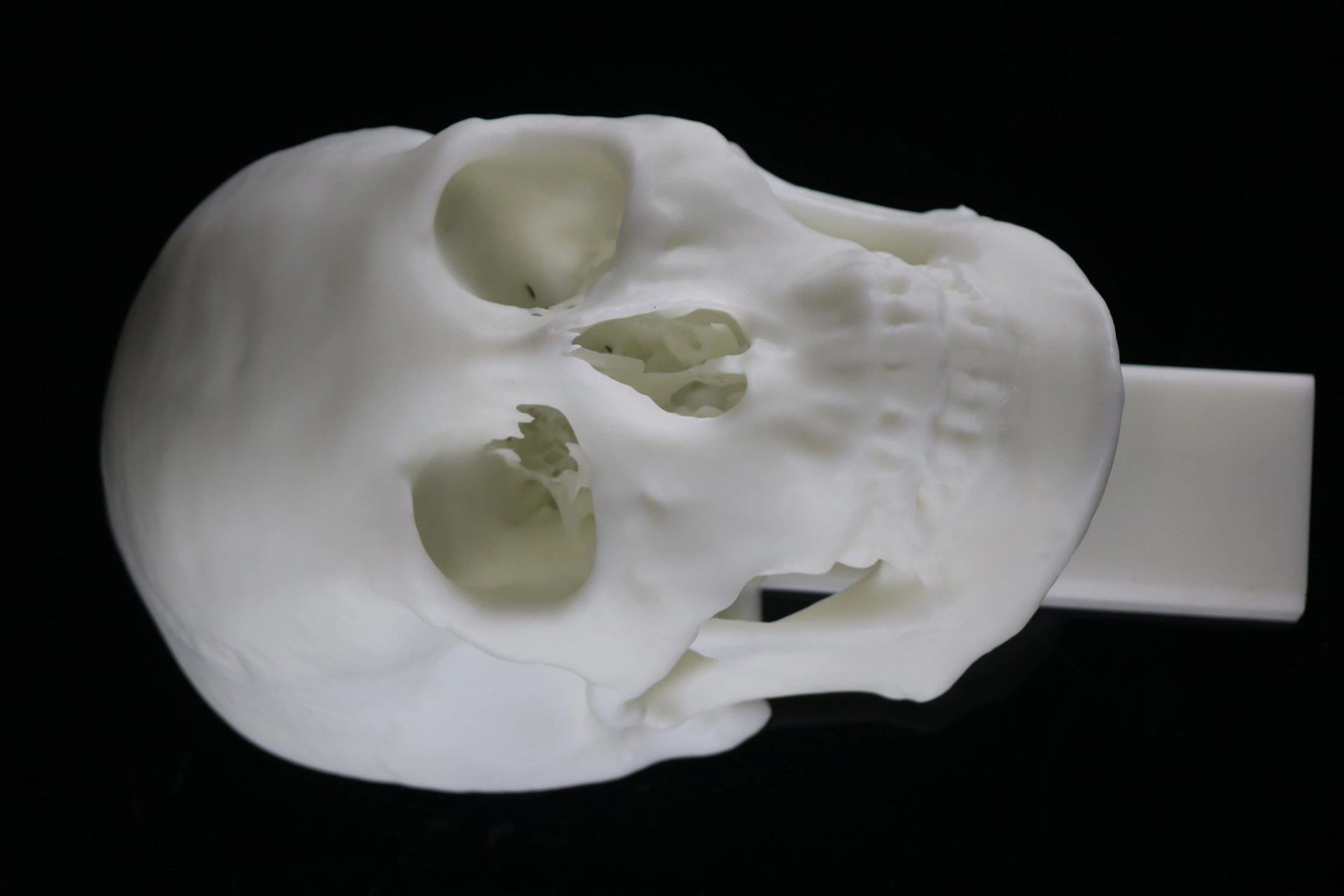 3D Printing SLA Resin Material Skull Preoperative Planning, Medical