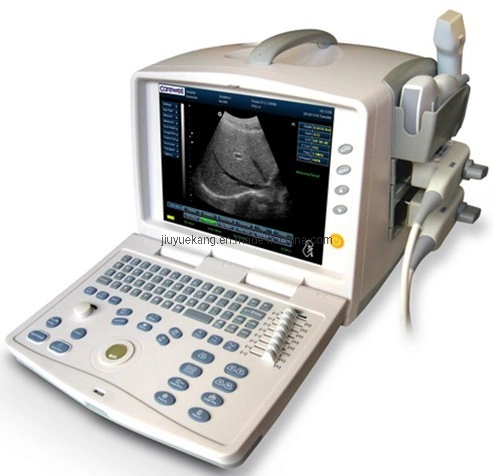 Medical Equipment, Portable 16 Channel Digital Ultrasound Scanner