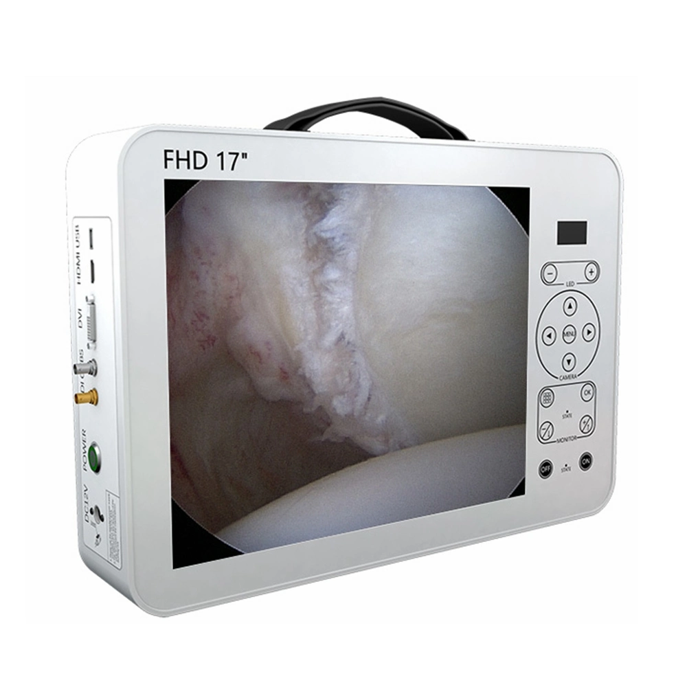 Medical Portable Endoscopy Camera System for Laparoscopy/Urology/Hysteroscopy