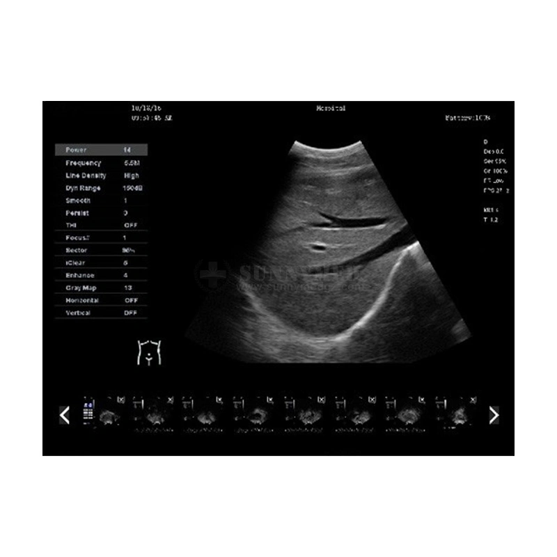 Sy-A042n Máquina de ecografía clínica Hospital de la sonda de ultrasonido Escáner portátil