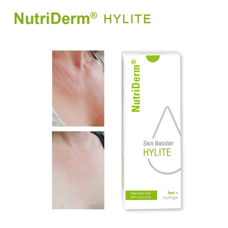 Nutriderm Korea Cuidados de la piel ácido Hialurónico Ampoule refuerzo de blanqueamiento de la piel Suero para mesoterapia