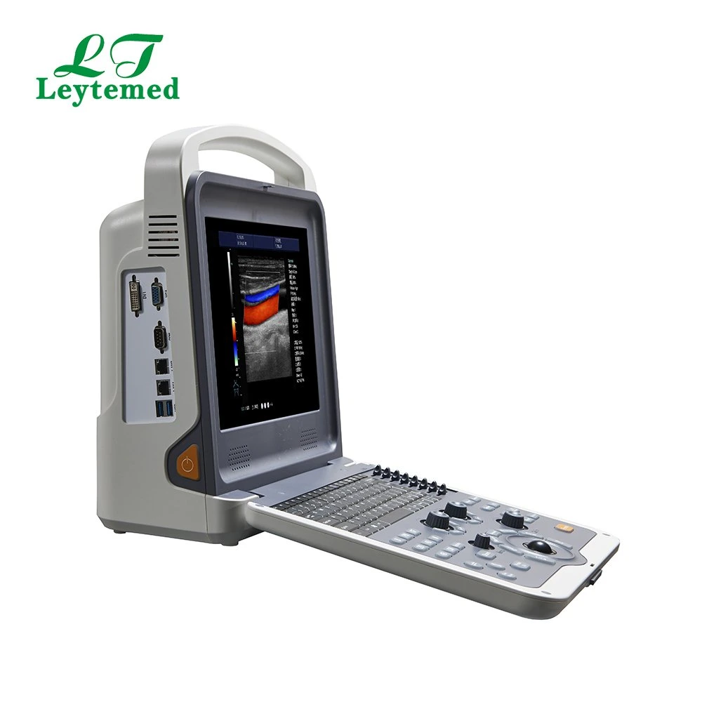 Ltub01V Vet Portable Color Ultrasound Scanner for Hospital