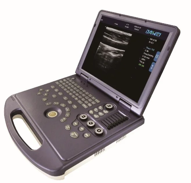 Dw-360 Intelligent High Quality 2D Ultrasound with Pw Model