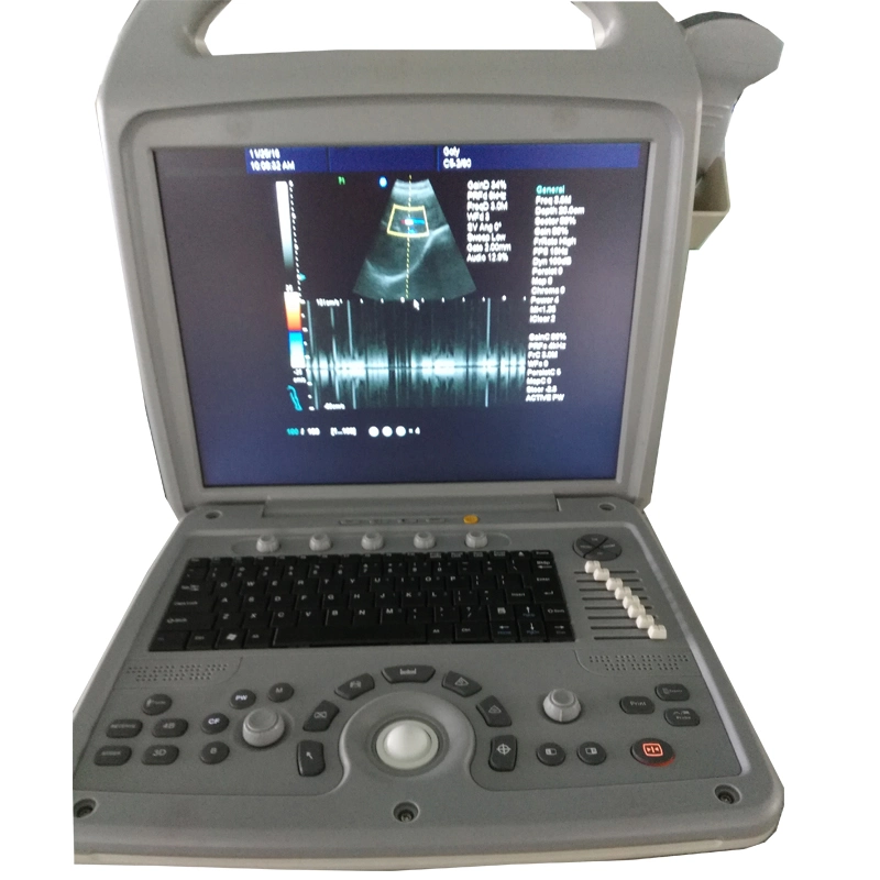 My-A027 3D Full Digital Color Doppler Ultrasound